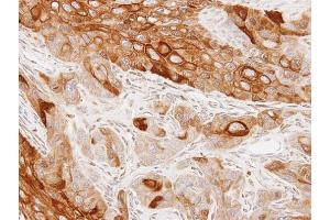 IHC-P Image Immunohistochemical analysis of paraffin-embedded SCC4 xenograft, using GAS2L1, antibody at 1:100 dilution. (GAS2L1 anticorps)