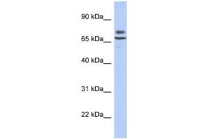 WB Suggested Anti-C3orf39 Antibody Titration:  0. (C3orf39 anticorps  (N-Term))