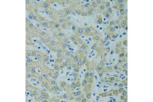 Immunohistochemistry of paraffin-embedded human liver using STX1A antibody (ABIN1876774) at dilution of 1:100 (40x lens). (STX1A anticorps)
