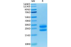 Mouse IL-17A on Tris-Bis PAGE under reduced condition.