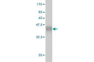 Western Blot detection against Immunogen (37. (ZNF41 anticorps  (AA 221-321))