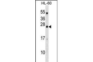 C18orf26 Antibody (N-term) (ABIN1539422 and ABIN2848478) western blot analysis in HL-60 cell line lysates (35 μg/lane). (DYNAP anticorps  (N-Term))
