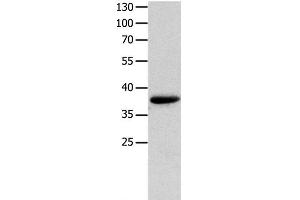 Western Blot analysis of Mouse muscle tissue using MYOZ1 Polyclonal Antibody at dilution of 1:1000 (Myozenin 1 anticorps)