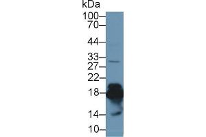 Detection of SOD1 in Mouse Liver lysate using Polyclonal Antibody to Superoxide Dismutase 1 (SOD1) (SOD1 anticorps  (AA 2-154))