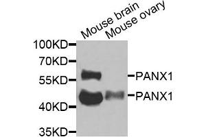 Western blot analysis of extracts of mouse brain and mouse ovary cells, using PANX1 antibody. (PANX1 anticorps)