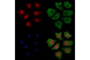 ABIN6256119 and ABIN6267471 staining HepG2 cells(4h of LPS treatment) by IF/ICC.