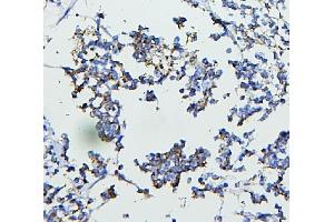 IHC analysis of CETP using anti-CETP antibody (ABIN7602439).