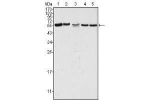 Western Blot showing PAK2 antibody used against Hela (1), Jurkat (2), A549 (3), HEK293 (4) and K562 (5) cell lysate. (PAK2 anticorps)
