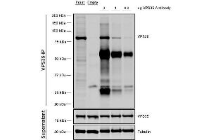 Immunoprecipitation analysis using Mouse Anti-VPS35 Monoclonal Antibody, Clone 11H10 (ABIN6933004). (VPS35 anticorps)