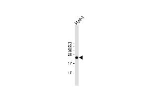All lanes : Anti-ORMDL3 Antibody (Center) at 1:1000 dilution Lane 1: Molt-4 whole cell lysate Lysates/proteins at 20 μg per lane. (ORMDL3 anticorps  (AA 53-81))