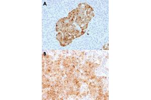 Immunohistochemical staining (Formalin-fixed paraffin-embedded sections) of human pancreas (A) and human parathyroid (B) with CHGA recombinant monoclonal antibody, clone CHGA/1731R . (Recombinant Chromogranin A anticorps)
