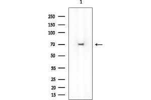 anti-Selenoprotein N, 1 (SEPN1) antibody