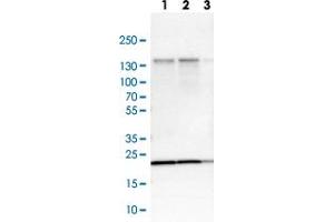 Western blot analysis of Lane 1: NIH-3T3 cell lysate (Mouse embryonic fibroblast cells) Lane 2: NBT-II cell lysate (Rat Wistar bladder tumour cells) Lane 3: PC12 cell lysate (Pheochromocytoma of rat adrenal medulla) with EIF4ENIF1 polyclonal antibody  at 1:250-1:500 dilution. (EIF4ENIF1 anticorps)