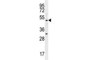 MEF2D antibody western blot analysis in ZR-75-1 lysate. (MEF2D anticorps  (AA 108-136))