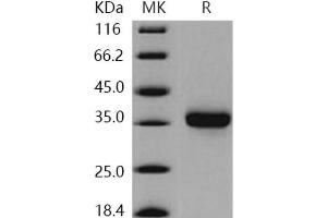 Western Blotting (WB) image for Kallikrein 8 (KLK8) (Active) protein (His tag) (ABIN7196673) (Kallikrein 8 Protein (KLK8) (His tag))
