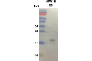 anti-Human Papilloma Virus 16 E6 (HPV-16 E6) (AA 1-158) antibody