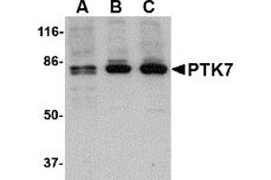 Image no. 1 for anti-PTK7 Protein tyrosine Kinase 7 (PTK7) (N-Term) antibody (ABIN203728) (PTK7 anticorps  (N-Term))