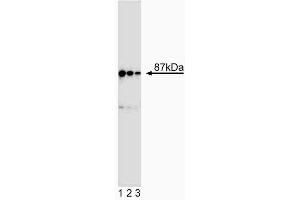 Western blot analysis of Ikkbeta. (IKBKB anticorps  (AA 1-666))