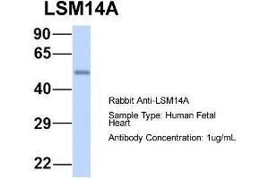 Host: Rabbit  Target Name: LSM14A  Sample Tissue: Human Fetal Heart  Antibody Dilution: 1. (LSM14A anticorps  (C-Term))