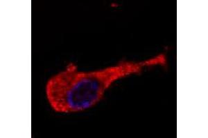 Immunofluorescence staining of neurofilament medium protein in murine Neuro2A cells by Neurofilament medium protein monoclonal antibody, clone NF-09  conjugated with Dyomics 547 (red).