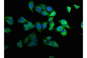 Immunofluorescence staining of HepG2 cells with ABIN7169172 at 1:100, counter-stained with DAPI. (Sbk2 anticorps  (AA 62-330))