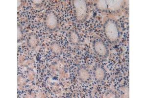 Used in DAB staining on fromalin fixed paraffin- embedded stomach tissue (VPREB1 anticorps  (AA 33-135))