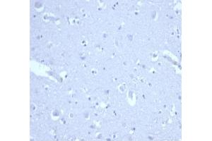 IHC analysis of formalin-fixed, paraffin-embedded human brain.
