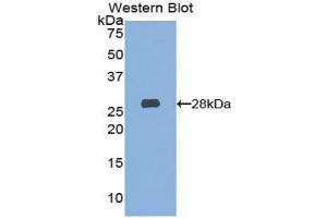 Western blot analysis of the recombinant protein. (Hexosaminidase A anticorps  (AA 319-528))