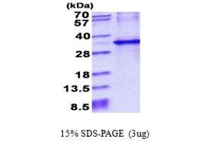 SDS-PAGE (SDS) image for Cytochrome B5 Reductase 1 (CYB5R1) (AA 29-305) protein (His tag) (ABIN5852942)