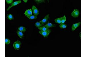 Immunofluorescent analysis of HepG2 cells using ABIN7145729 at dilution of 1:100 and Alexa Fluor 488-congugated AffiniPure Goat Anti-Rabbit IgG(H+L)