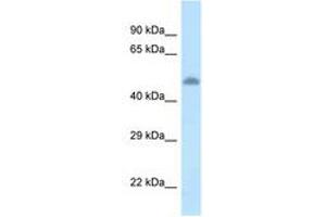 Image no. 1 for anti-tyrosine Aminotransferase (TAT) (AA 361-410) antibody (ABIN6747577)