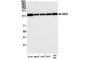 anti-IWS1 Homolog (IWS1) (AA 1-50) antibody