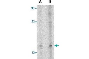 Western blot analysis of NRN1 in Daudi cell lysate with NRN1 polyclonal antibody  at (A) 5 and (B) 10 ug/mL . (NRN1 anticorps  (Internal Region))