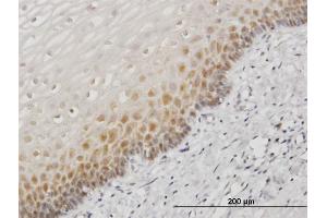 Immunoperoxidase of monoclonal antibody to HSPA1B on formalin-fixed paraffin-embedded human esophagus. (HSPA1B anticorps  (AA 531-611))