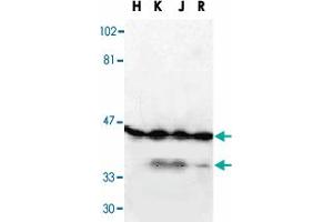 Western blot analysis of DFFA in HeLa, (H), K-562 (K), Jurkat (J), and Raji (R) whole cell lysate with DFFA polyclonal antibody  at 1 : 1000 dilution. (DFFA anticorps  (AA 2-21))