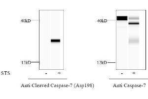 HeLa cells were treated or untreated with STS.