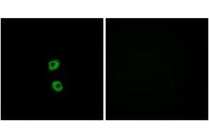Immunofluorescence analysis of MCF7 cells, using FZD7 Antibody. (FZD7 anticorps  (AA 45-94))