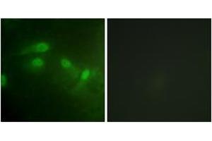Immunofluorescence analysis of HeLa cells, using MDM2 (Phospho-Ser186+Ser188) Antibody. (MDM2 anticorps  (pSer186))