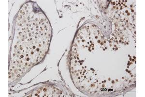Immunoperoxidase of purified MaxPab antibody to LYAR on formalin-fixed paraffin-embedded human testis.