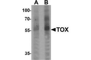 Western blot analysis of TOX in human colon tissue lysate with TOX Antibody  at (A) 1 and (B) 2 μg/ml. (TOX anticorps  (N-Term))