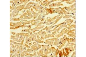 Immunohistochemistry of paraffin-embedded human heart tissue using ABIN7160220 at dilution of 1:100 (SMAD1 anticorps  (AA 150-250))