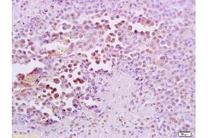 Formalin-fixed and paraffin embedded mouse lymphoma tissue labeled with Anti-FRA2/FOSL2 Polyclonal Antibody, Unconjugated (ABIN673104) at 1:200 followed by conjugation to the secondary antibody and DAB staining (FOSL2 anticorps  (AA 231-326))
