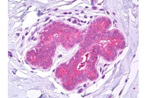 Anti-IST1 antibody IHC of human breast. (IST1 anticorps)