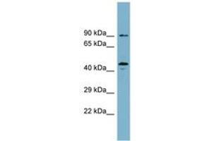 Image no. 1 for anti-WD Repeat Domain, phosphoinositide Interacting 1 (WIPI1) (AA 35-84) antibody (ABIN6744114) (WIPI1 anticorps  (AA 35-84))