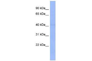 WB Suggested Anti-ZNF193 Antibody Titration:  0. (Zinc Finger and SCAN Domain Containing 9 (ZSCAN9) (N-Term) anticorps)