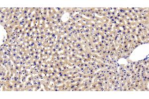 anti-Insulin Receptor (INSR) (AA 1101-1372) antibody