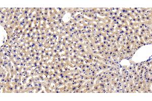 Detection of INSR in Mouse Liver Tissue using Polyclonal Antibody to Insulin Receptor (INSR) (Insulin Receptor anticorps  (AA 1101-1372))