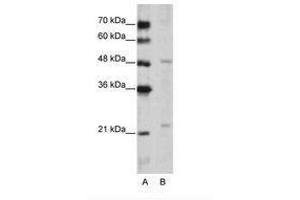 Image no. 1 for anti-WD Repeat Domain 12 (WDR12) (C-Term) antibody (ABIN202489) (WDR12 anticorps  (C-Term))