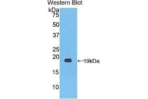 Western blot analysis of the recombinant protein. (Factor VIII anticorps  (AA 1887-2044))