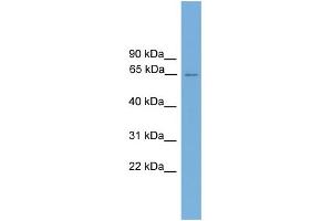 WB Suggested Anti-CARD9 Antibody Titration: 0. (CARD9 anticorps  (Middle Region))